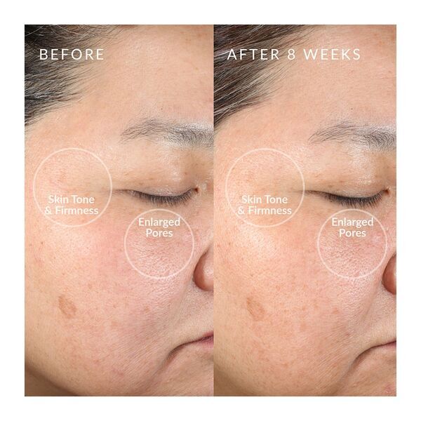 PMD® Beauty Clean Face Cleaning Brush